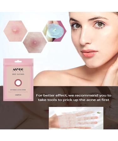 Buy Acne Patches - Invisible Hydrocolloid Spot Stickers for Fast Healing | 108 Translucent Pimple Patches Two Sizes Available - International Shipping - Buy Online on SooperMarket.com