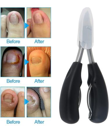 Toenails Trimmer Toenail Clippers for Ingrown or Thick Nails Cuticle Nipper Trimmer Toenail Nipper for Seniors with Protective Cover Stainless Steel Nail Scissors for Ingrown Hard Toe Nail Fingernail - Buy Online on SooperMarket.com