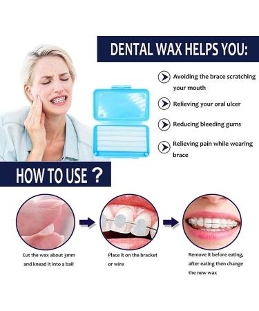 Dental Wax for Braces - Mint Orthodontic Wax (1 Box, 50 Uses) - Buy Online on SooperMarket.com