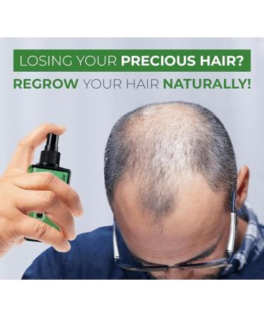 Neo Hair Lotion  120 ml - Buy Online on SooperMarket.com