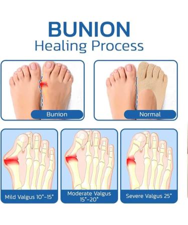 Projoint Antibunions Health Sock - StrongJoints & Bunion Pain Relief Socks (5 Pairs, Black) - Buy Online on SooperMarket.com