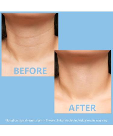 KISSIO 5% Collagen Neck Cream - Firming Lifting & Hydrating Peptide Cream for All Skin Types - 2.12 Oz - Buy Online on SooperMarket.com