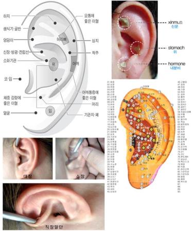 Dong Bang Sterile Ear Acupuncture Disposable Press Patches x 500pcs - Buy Online on SooperMarket.com