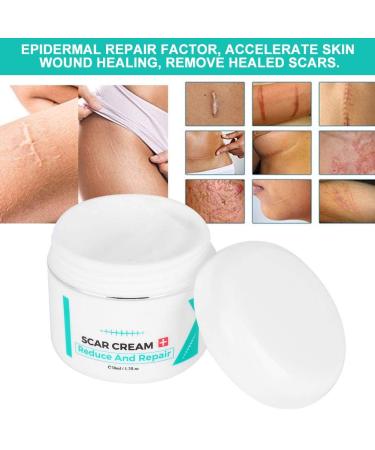 Scar Removal Cream | Stretch Marks Serum | Skin Repair Treatment - Buy Online on SooperMarket.com