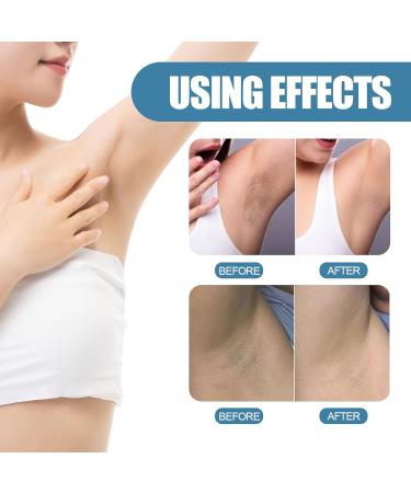 Underarm Whitening Cream Natural Armpit Whitening Cream Effective Body Skin Lightening & Brightening Cream for Knees Elbows Sensitive & Private Areas Whitens Nourishes Restores Skin - Buy Online on SooperMarket.com