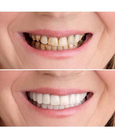 LAMILL DIY Dentures Teeth Veneers for Men and Women - Elastic Tooth Cover - Perfect Smile Solution (2 PCS) - Buy Online on SooperMarket.com
