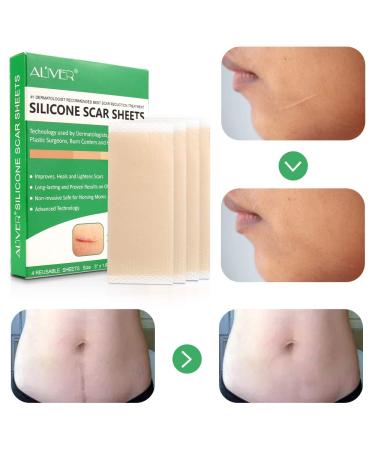 Silicone Scar Sheets - Advanced Treatment for Old & New Scars - 2 Months Supply - Buy Online on SooperMarket.com