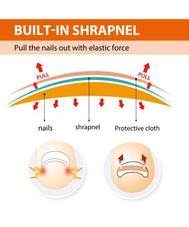 152-Piece Ingrown Toenail Tool Set | Toenail Correction Patch Clasp & Files for Pain Relief - Ship Internationally - Buy Online on SooperMarket.com