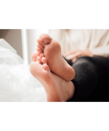 Buy Alva Foot Care Callus Balm 30 ml - Best Soothing Treatment for Soft Feet | International Shipping - Buy Online on SooperMarket.com