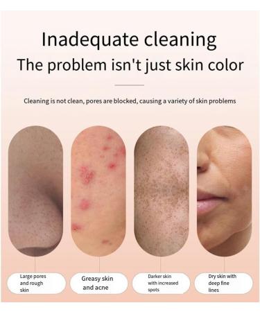 MRNHA Electric Blackhead Remover Face Pimple Extraction Deep Spots Pore Acne Removal Cleaner Cleanser - Buy Online on SooperMarket.com