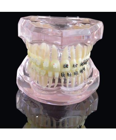 LBYLYH Orthodontic Demonstration Model - Teeth Teaching Tools with Metal & Ceramic Support for Effective Dental Treatment - Buy Online on SooperMarket.com