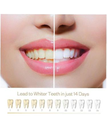 1pc Teeth Whitening Pen Tooth Whitening Gel Tooth Bleach Gel Whitener Remove Stains Toothpaste Pen Oral Hygene Dental Care - Buy Online on SooperMarket.com