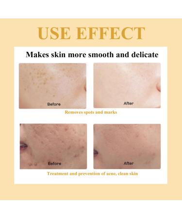 Turmeric Kojic Acid Cleansing Pads - Brightening Face Scrub for Dark Spots | 50pcs Gentle & Safe Skin Balance - Buy Online on SooperMarket.com