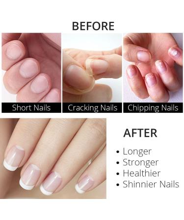 Excuse Me Nail Hardener 0.5 oz - Advanced Formula Strengthener for Nail Growth (Pack of 1) - Buy Online on SooperMarket.com
