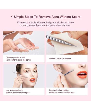 Blackhead Remover Comedone Squeezer Set Blackhead Remover Pore Cleanser Facial Cleansing Pimples Acne Whiteheads Blackhead Remover Kit with Box of 4 - Buy Online on SooperMarket.com