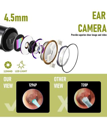 Smart Wireless Ear Wax Removal Tool Camera | Visual Ear Cleaner Kit for Babies, Kids, Adults, Pets | 1296P Ear Otoscope Scope with Cleaning Tool - Buy Online on SooperMarket.com