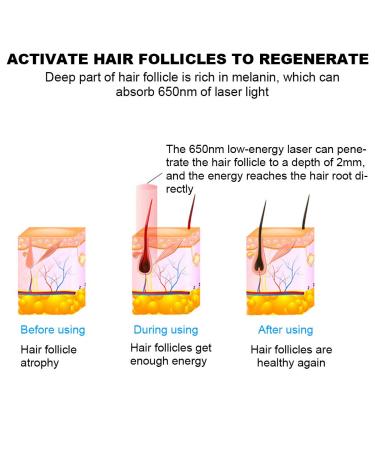 Hair Growth Helmet & Cap - 180 Light Chips for Thicker Fuller Hair | Effective Hair Loss Treatment & Therapy - Buy Online on SooperMarket.com