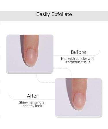Cuticle Remover Gel - Gentle Softener, Moisturizes, Dissolves Dry Cuticles in 1 Minute - Improve Nail Growth - Buy Online on SooperMarket.com