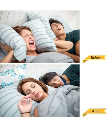 Anti-Snore Chin Strap for Men and Women - Stop Snoring with Comfort - Buy Online on SooperMarket.com