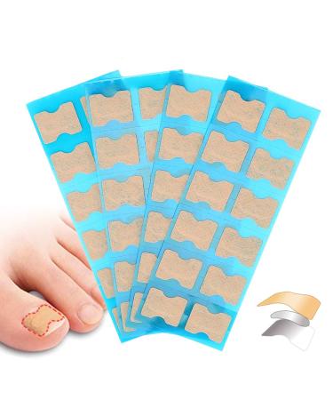Ingrown Toenail Stick Patch 4 Sizes Glue-free Toe Nail Correction File Patch Paronychia Corrector Foot Care Treatment Pedicure Tool Ingrown Toenail Correction Patch(1#)
