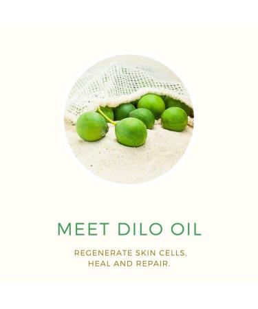 PURE FIJI Dilo Rescue Body Spray - After Sun Moisturizing Travel Size 2oz - Soothes Sunburn, Hydrates Skin - Buy Online on SooperMarket.com