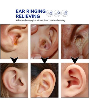 Tinnitus Relief Spray 60ml Anti Tinnitus Spray Earwax Cleaning Care Spray for Relieves Tinnitus Ear Back Ear Discomfort - Buy Online on SooperMarket.com