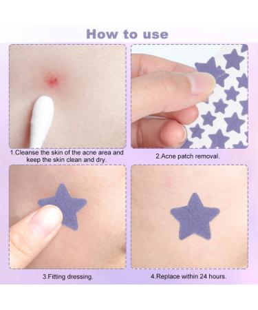 112 Dots Spot Patches Pimple Patches Cute Star Pimple Patches Spot Stickers Treatment Face Back Acne Dots 4 Colors 14mm & 10mm - Buy Online on SooperMarket.com