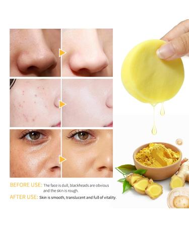 Kojic Acid Turmeric Cleansing Pads - 80 Pads for Dark Spot Fading Pore Shrinking & Oil Control - Smooth & Soft Skin Repair - Buy Online on SooperMarket.com
