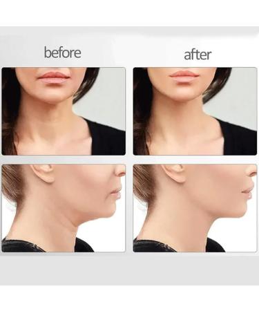 Nadove Micro-Glow Facial Nadove Micro Glow Face Sculptor Micro Glow Facial Machine Microcurrent Multifunctional Facial Massager Double Chin Eliminator (Black+Red) - Buy Online on SooperMarket.com