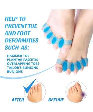 Mroobest Toe separator Toe spacers Gel Toe Separators Bunion Correctors Toe Spacers Toe Straightener Toe Stretcher Big Toe Correctors Toe Separator 4 Count (Blue) blue-1 One Size - Buy Online on SooperMarket.com