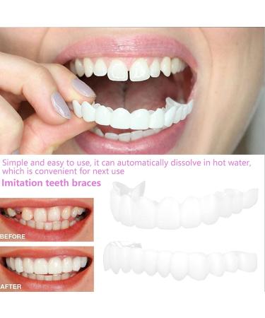 icehao Upper & Lower Teeth Veneers - Simulation Braces Snap On Smile Tooth Cover for Perfect Whitening - One Size Fits Most Comfortable Denture - 2pcs Set - Buy Online on SooperMarket.com