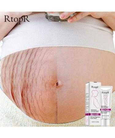 Ofanyia Stretch Mark Removal Cream - Effective Repair for Scars & Pregnancy Marks | International Shipping - Buy Online on SooperMarket.com