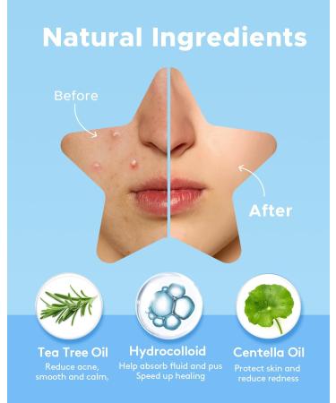 LitBear Acne Pimple Patch 6 Colors 168 Dots Star Pimple Patches with Case Tea Tree Oil & Centella Oil Hydrocolloid Acne Pimple Patches for Face Cute Zit Patches Pimple Stickers Acne Dots - Buy Online on SooperMarket.com