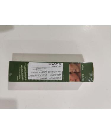 Facial Black Spot Remover Cream Facial Correction Cream Nicotinamide Facial Essence Skin Repair for Lightening Sunburn and Acne Marks Lightening Pigmentation and Rapidly Improving Skin Color 50 ml - Buy Online on SooperMarket.com