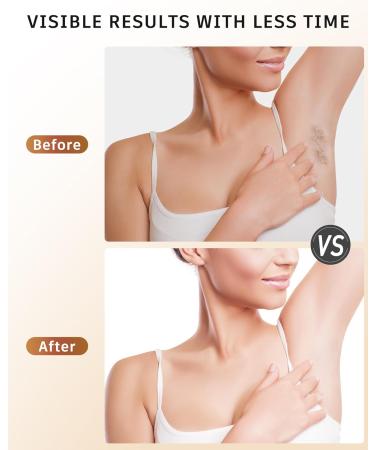 Aopvui IPL At-Home Hair Removal Device for Men & Women - 999 999 Flashes for Permanent Hair Removal | Safe & Effective Hair Remover for Arms Legs Back & Full Body - Buy Online on SooperMarket.com