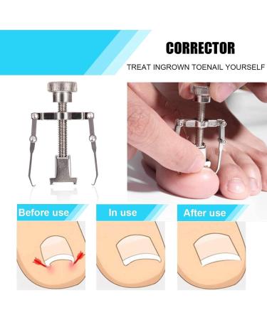OosoFitt 7Pcs Stainless Steel Ingrown Toenail Clippers Set - Professional Toe Nail Nippers for Surgery Grade Manicure Pedicure - Silver - Buy Online on SooperMarket.com