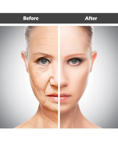 MFUOE 3 Pieces Face Wrinkle Patches Set Forehead Patch Eye Patch Silicone Patch Wrinkle Removal Products Eliminate Wrinkles Fine Lines Skin Care Tools - Buy Online on SooperMarket.com