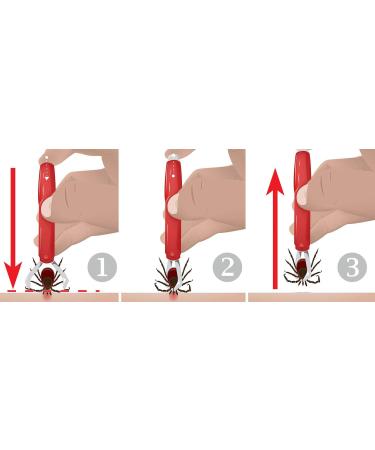 valonic tick remover 2 pack red tick removal tool tick remover for dogs and cats - Buy Online on SooperMarket.com