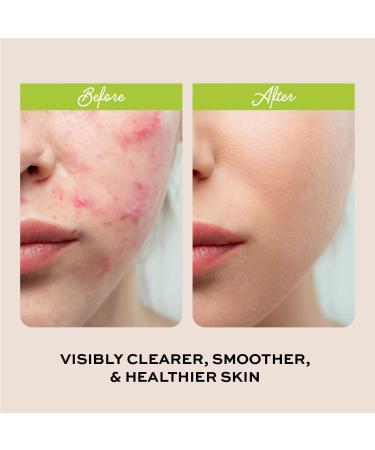 The Natural and Organic Family Clarifying Face Wash with Salicylic Acid - Facial Cleanser for Oily Normal and Combination Skin - Exfoliating Pore Minimizing Formula for Teens and Kids Face Wash Apple - Buy Online on SooperMarket.com