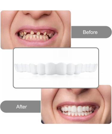 Buy False Teeth & Cosmetic Veneers - Temporary Braces for Perfect Smile | Ship Internationally - Buy Online on SooperMarket.com
