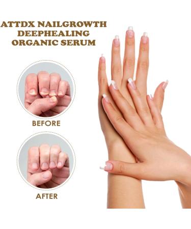 NailGrowth DeepHealing Organic Serum NailGrowth Serum Reconstrux Nail Growth Nail Growth and Strength Serum Nail Growth Serum Nail Repair Essence Serum 30ml (3Pcs) - Buy Online on SooperMarket.com