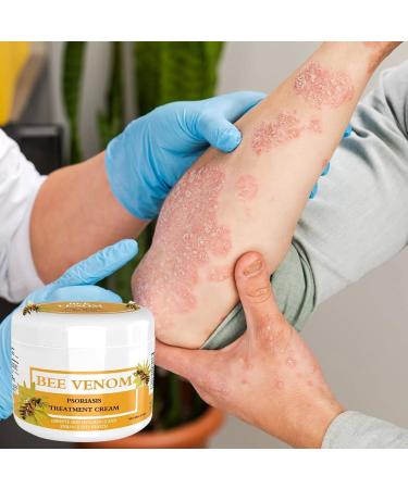 Bee Venom Cream Bee Venom Psoriasis Cream for All Skin Types Easy Application & No Irritation 30g - Buy Online on SooperMarket.com