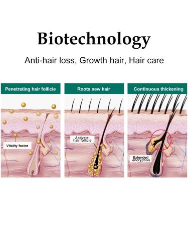 Hair Growth Serum - Thicker Longer Fuller Hair | Prevent Hair Loss & Thinning | Vitamin-Rich Natural Treatment - Shop Now - Buy Online on SooperMarket.com