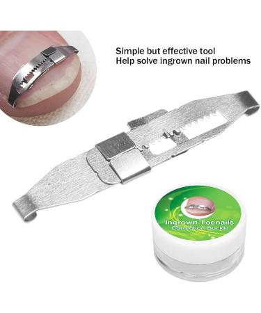 Ingrown Toenail Treatment Stainless Steel Ingrown Toenail Corrector Relief Paronychia Treatment Correcting Tool - Buy Online on SooperMarket.com