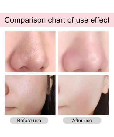 AHA 30%+BHA 2% Face Serum Dark Spot Remover for Face Face Serum for Women Brightening Serum Peeling Serum Solution Anti Aging Serum for Face Smooth Skin Exfoliating Reduce Fine Line Moisturiser Face - Buy Online on SooperMarket.com