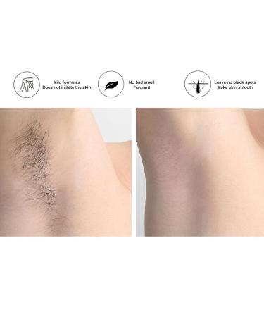 Roll-On Guard Cartridge - Fast Hair Removal Safe & Gentle Portable Design for Arms Legs Armpits Bikini Zone & Back - Blue - Buy Online on SooperMarket.com