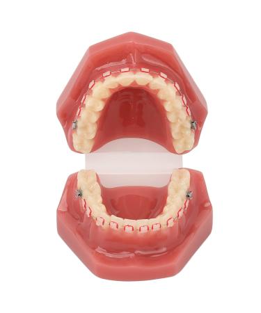 Orthodontic Demonstration Model for Dental Research | Metal Wires & Ceramic Brackets | Teaching Aids for Adults - Buy Internationally - Buy Online on SooperMarket.com
