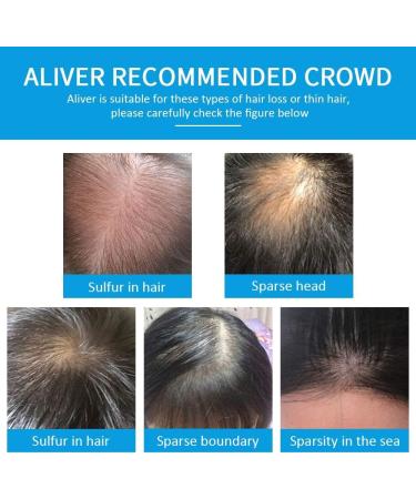 Aliver Hair Fibres Medium Brown Hair Loss Treatment - 15 Second Hair Thickener for Women & Men - Undetectable Natural Formula Spray Powder - Buy Online on SooperMarket.com