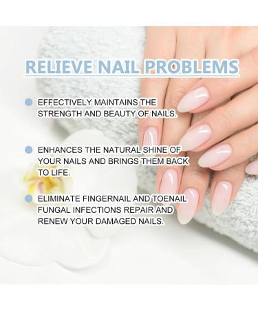 HOPASRISEE Onyxoguard Nail Growth and Repair Serum Onyxoguard Serum Nail Strengthener Nail Growth Serum Nail Growth and Strengthener Nail Serum for Strength and Growth (1) - Buy Online on SooperMarket.com