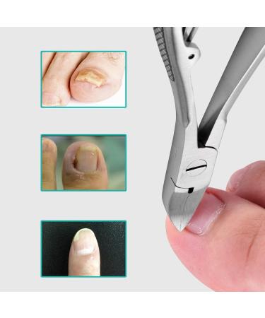 jklashfi 3X Professional Feet Toe Nail Clippers Trimmer Paronychia Nippers Podiatry Stainless Tools - Buy Online on SooperMarket.com
